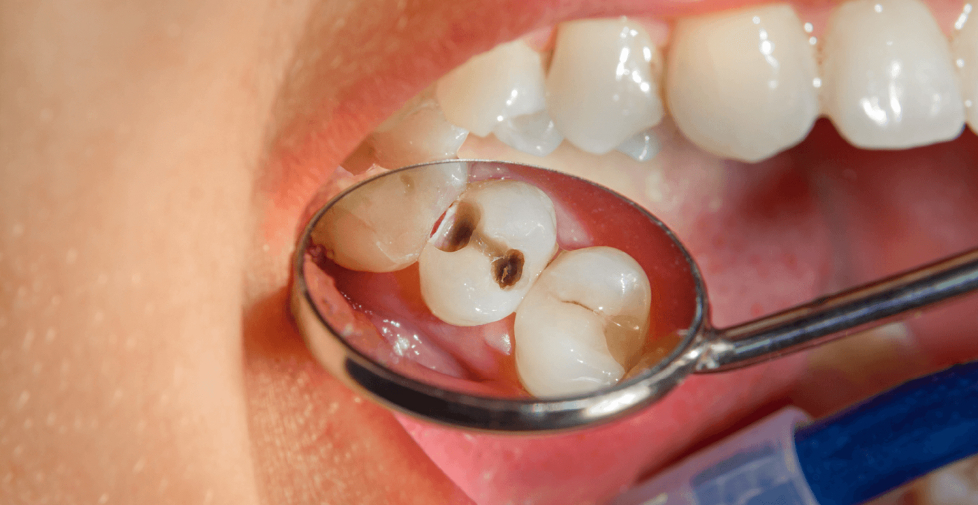 C&Aacute;RIE DENT&Aacute;RIA